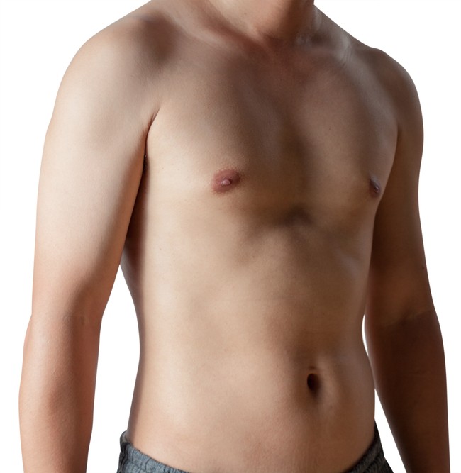 Gynecomastia and Male Breast Reduction