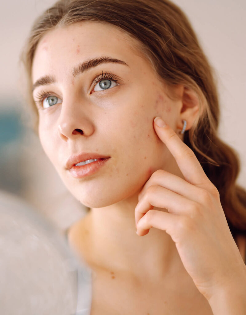 woman touching her cheek