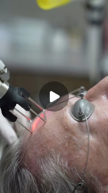 If you’re dealing with more than just wrinkles, CO2 Laser may be worth a look... This powerful resurfacing treatment can help improve sun damage, pigmentation, uneven texture, acne scars, and overall skin tone - making it a great option for addressing multiple skin concerns at once! For the month of September, save $600 on CO2 Laser treatments! This is our biggest special of the year, and appointments are limited. Call our office to schedule your consultation and reserve your spot!