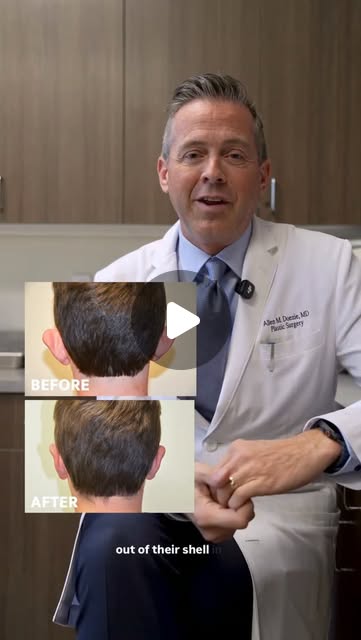 Feeling self-conscious about your ears? You’re not alone. Ear pinning (otoplasty) is a relatively simple procedure that can help you feel more comfortable and confident in your appearance. If you’re is considering ear pinning, schedule a consultation with Dr. Doezie to learn more!