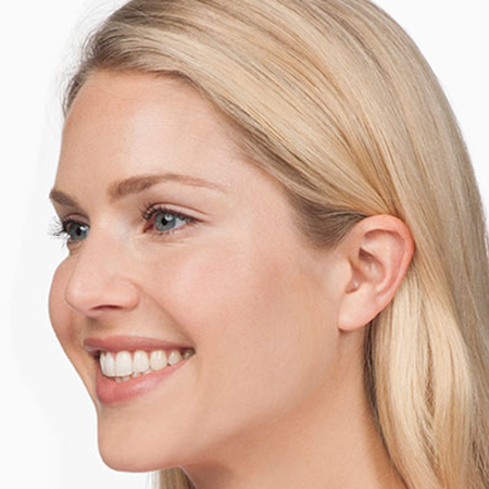 Botox---Cosmetic-01 | After Botox® Cosmetic 2