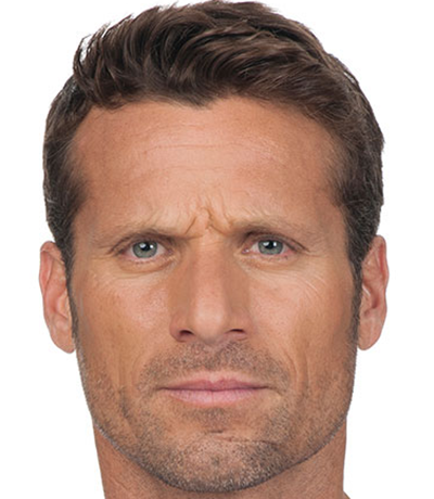 Botox---Cosmetic-02 | Before Botox® Cosmetic