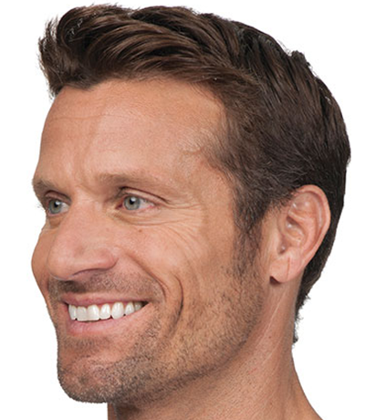 Botox---Cosmetic-02 | After Botox® Cosmetic 2